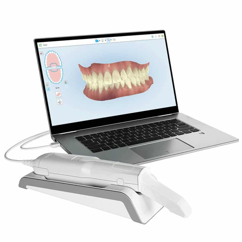 High-Precision iTero® Scans Without the Mess